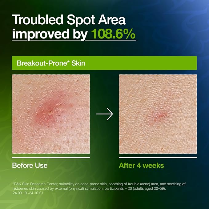 Azelaic Acid 10 Hyaluron Redness Soothing Serum 50ml