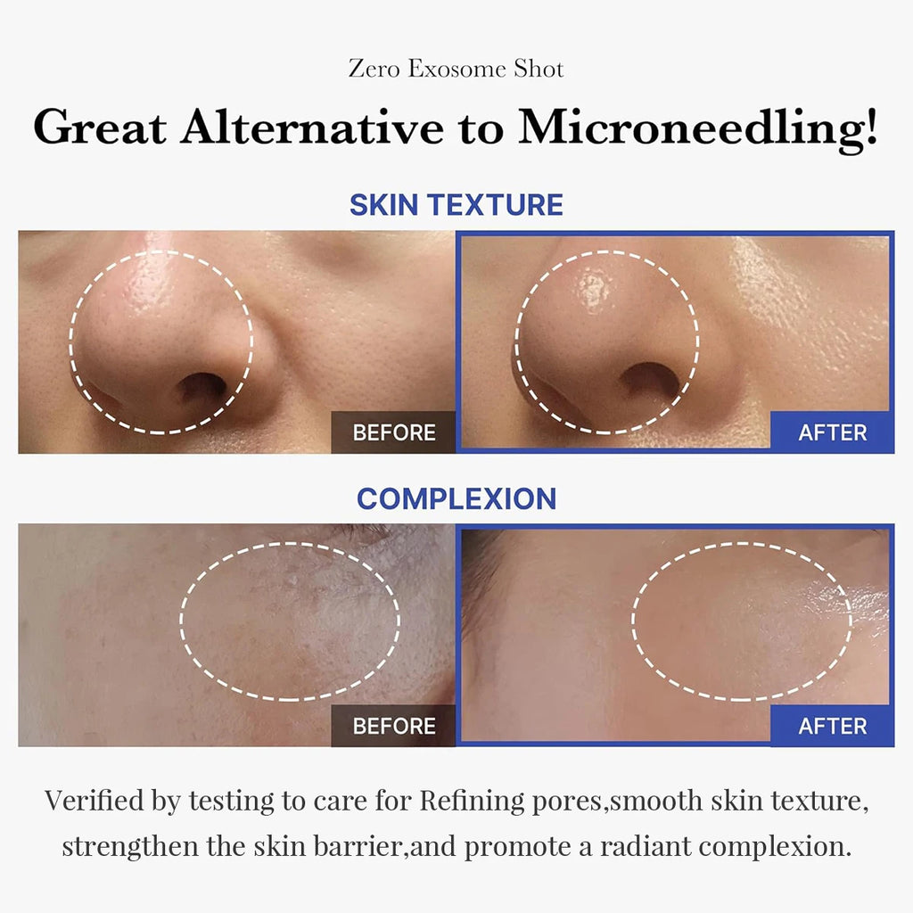 One Day Exosome Shot,Fast-Absorbing & Non-Sticky,Advanced Booster,Intensive Care,Korean Skincare,Korean Makeup