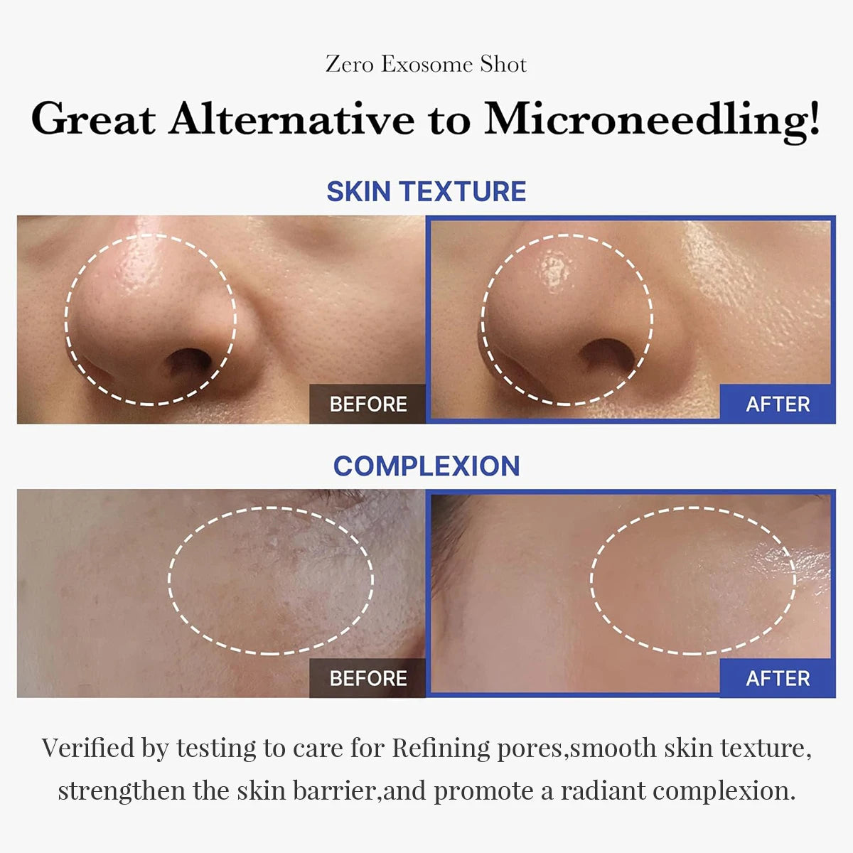 One Day Exosome Shot,Fast-Absorbing & Non-Sticky,Advanced Booster,Intensive Care,Korean Skincare,Korean Makeup